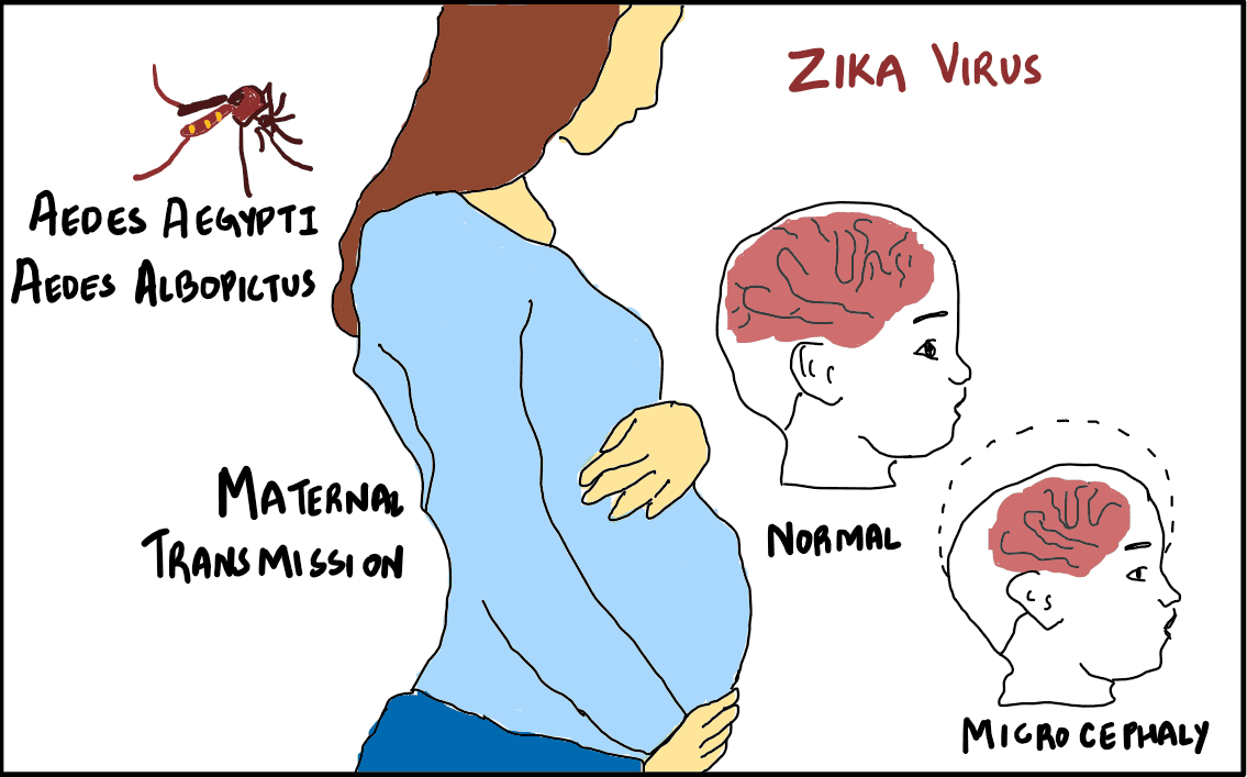 Zika Virus